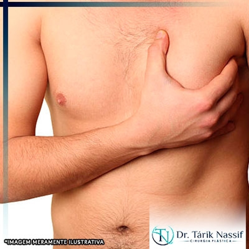 Молочной железы у мужчин симптомы. Уплотнение под молочной железой. Уплотнение под левой грудью.